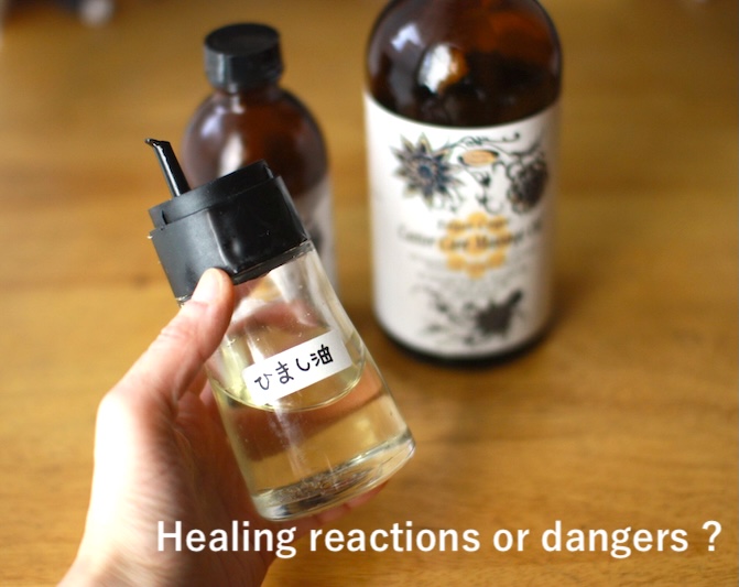 ひまし油パックの好転反応